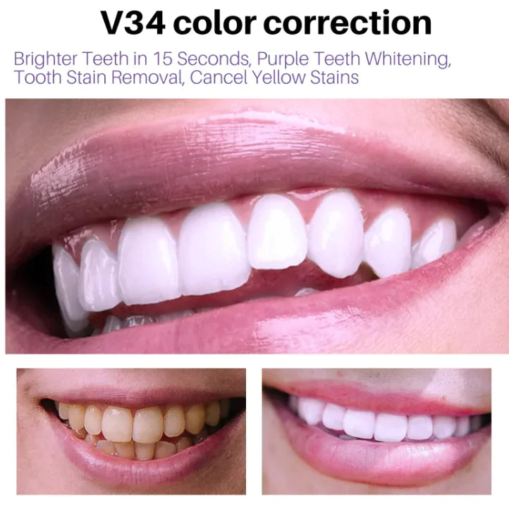 Smoke Stain Removal Teeth Mousse